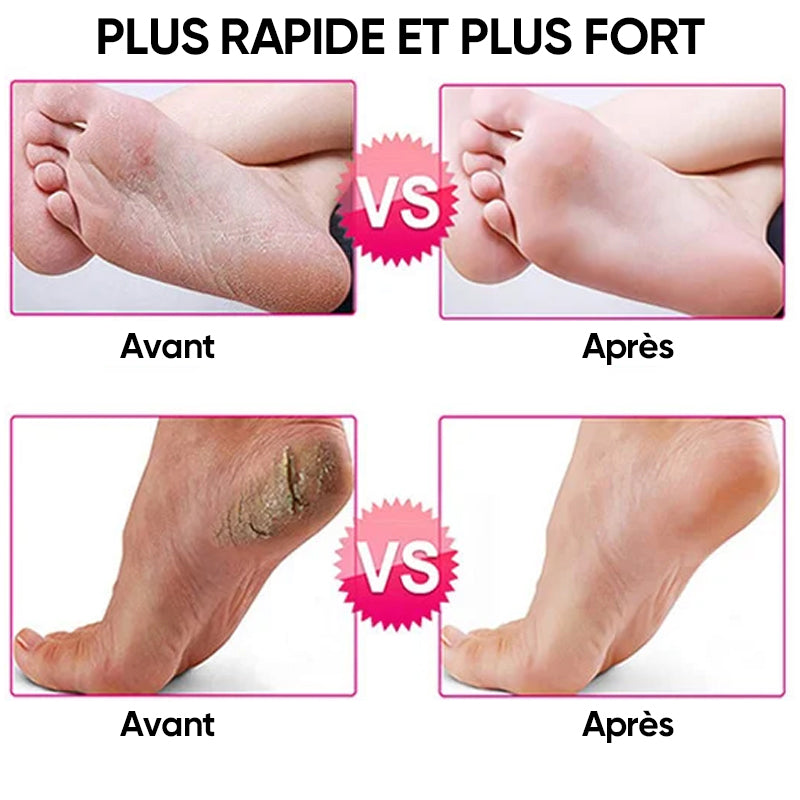 Pédicure électrique pour soins des pieds