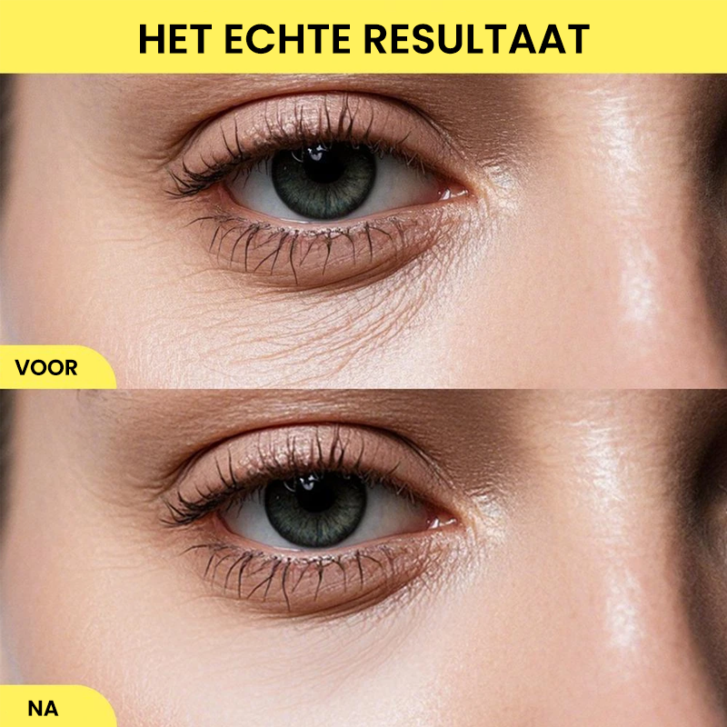 Revitaliserende oog- en gezichtscrème met probiotica, retinal en peptiden – 40 ml