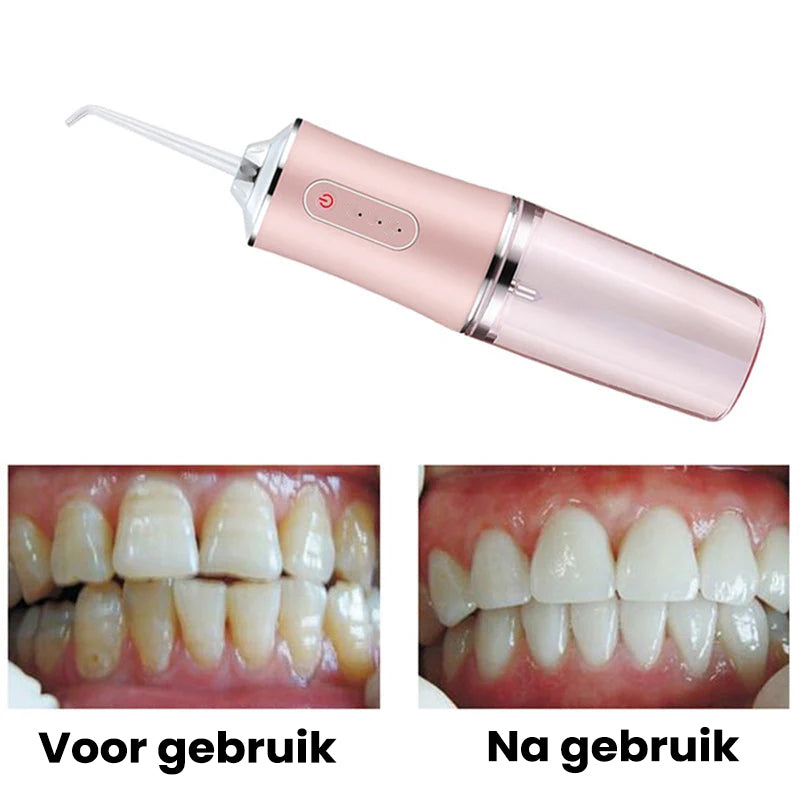 Draagbare tandheelkundige waterflosser