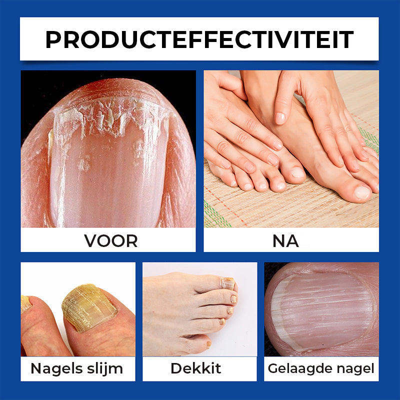 Nagelverzorgingslamp