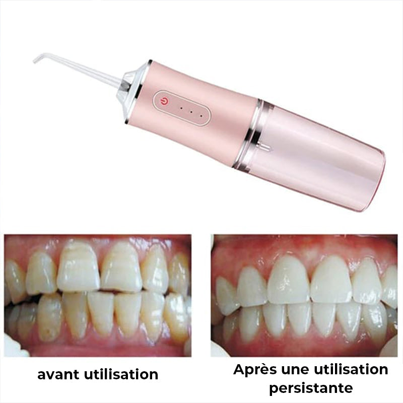 Portable Dental Water Flosser