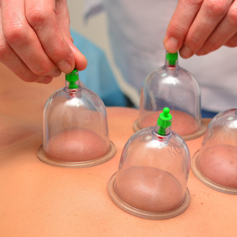 Cuppingset voor massagetherapie