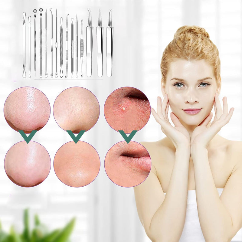 15-delige Roestvrijstalen Mee-eter & Acne Verwijder Set