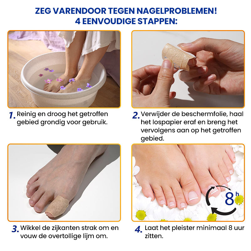 Aanbieding - Schimmelnagelpleisters