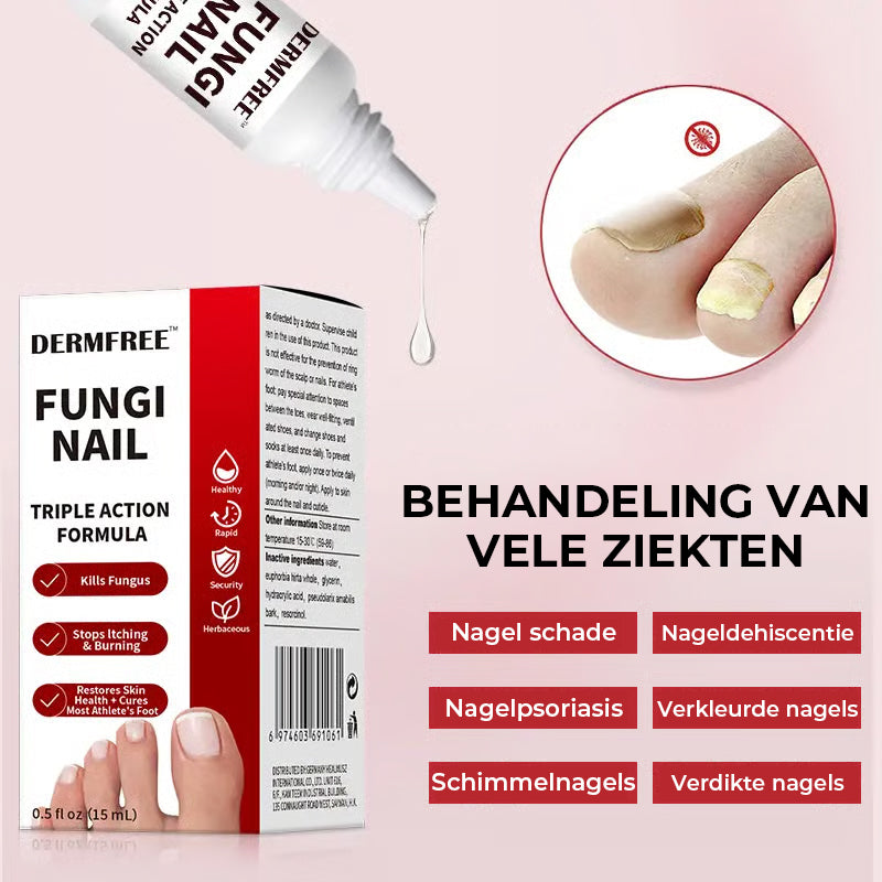 Extra sterke behandeling tegen schimmelnagels
