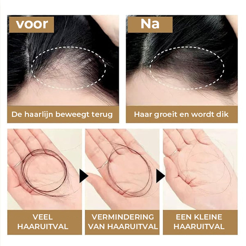 Anti-haaruitval shampoo tegen haaruitval