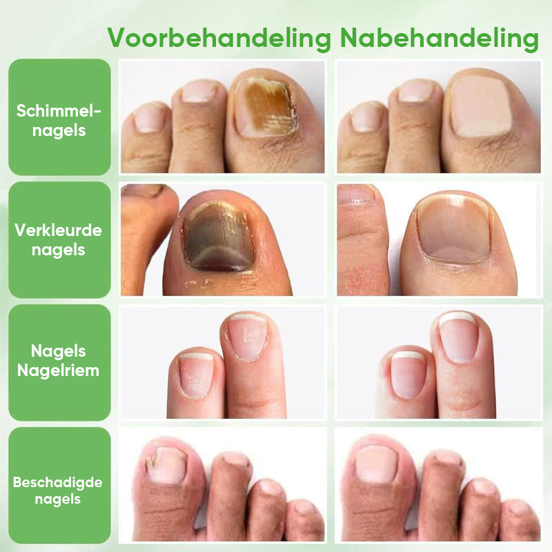 Gember Nagelbehandeling
