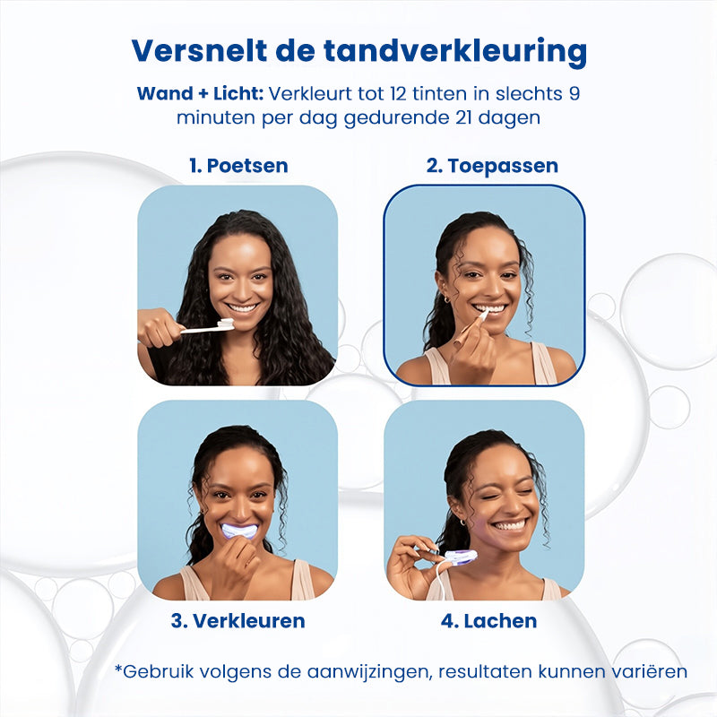 Whitening Pen voor het verwijderen van vlekken en wittere tanden