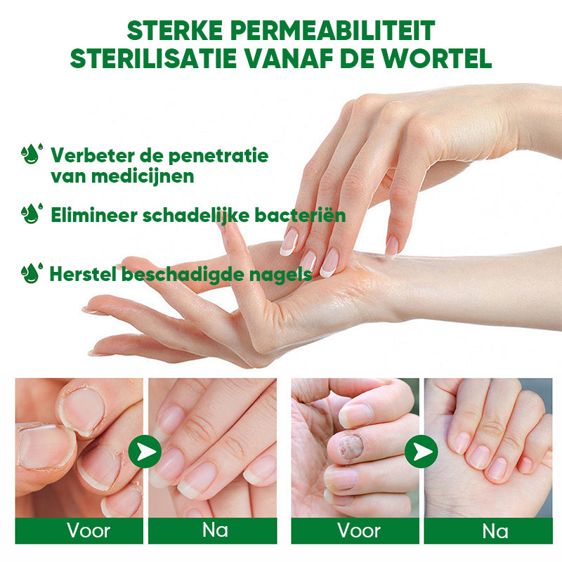 Gember Nagelbehandeling