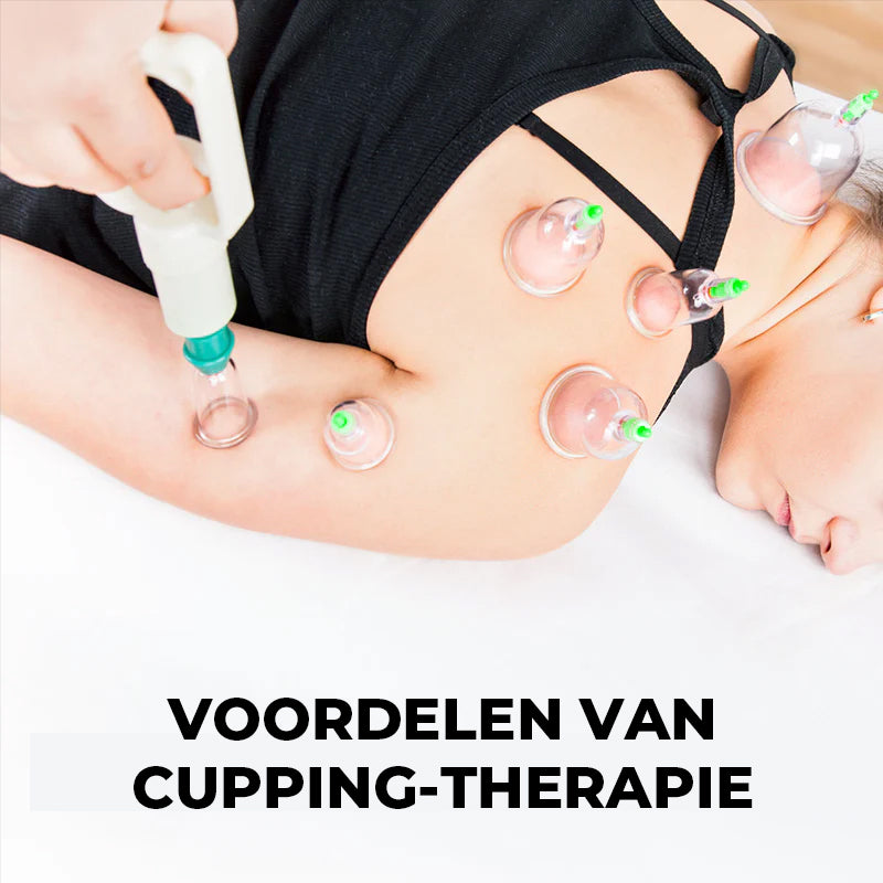 Cuppingset voor massagetherapie