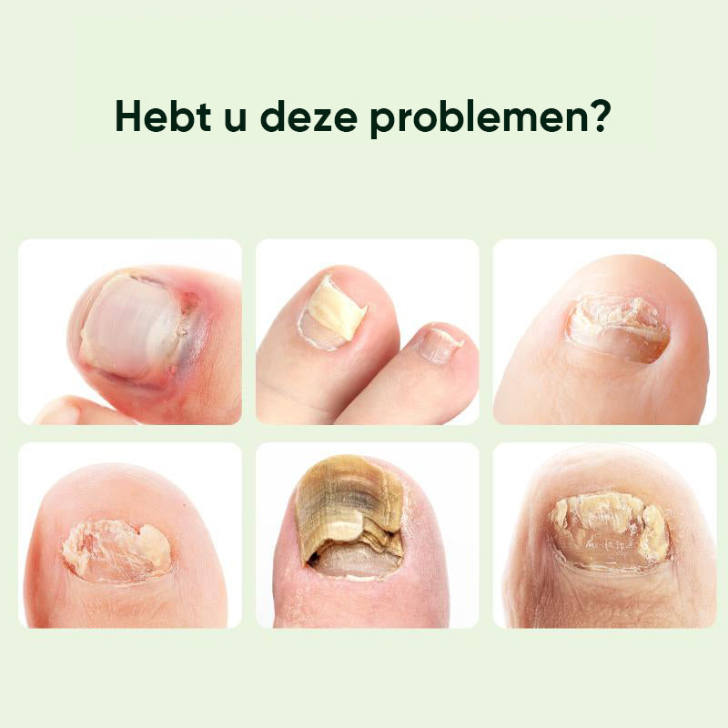 Nagelreparatie magische druppels