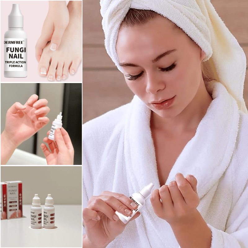 Traitement Anti Fongique Extra Fort pour Ongles d'Orteils
