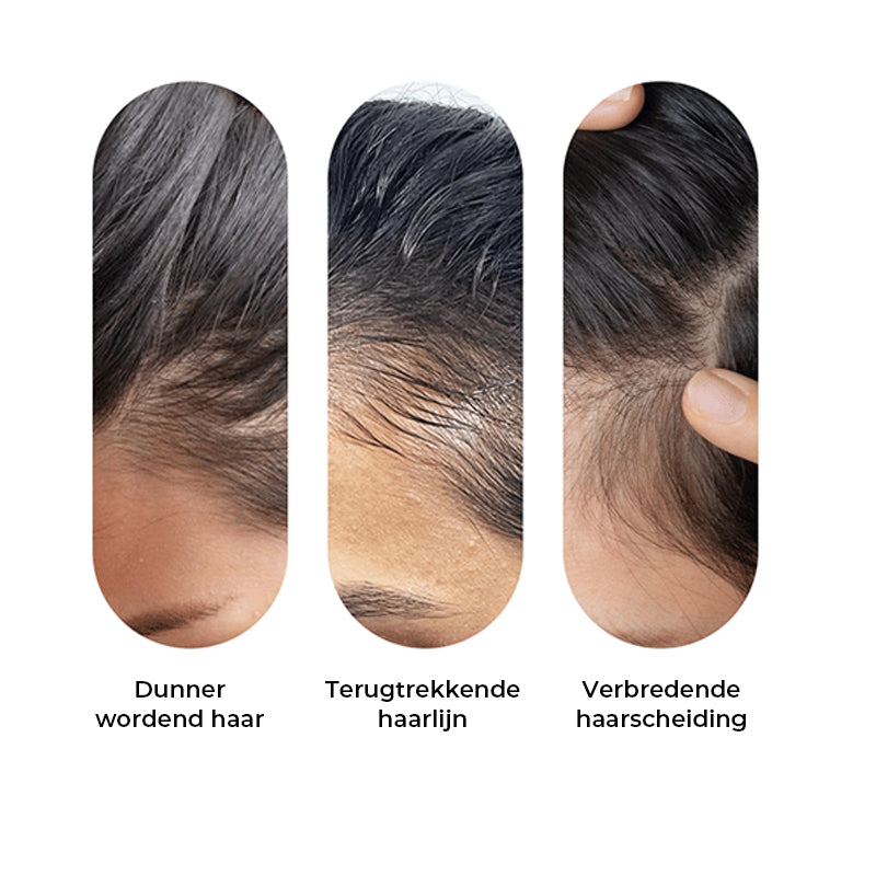 Geavanceerd haargroei roll-on serum