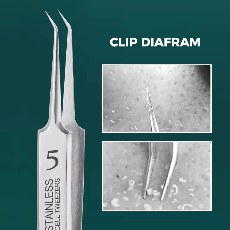 Pince à Epiler Ultra-fine pour Comédons de Nez