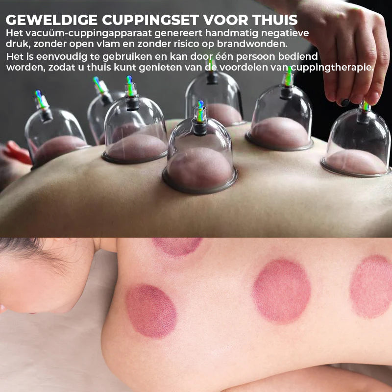 Cuppingset voor massagetherapie