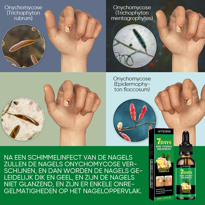 Gember Nagelbehandeling