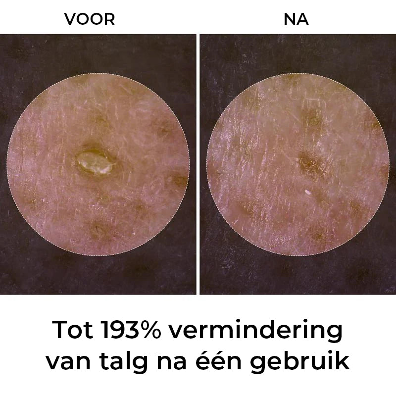 Gloeiende rijstampul set van twee - Serums voor verheldering, exfoliatie en hydratatie