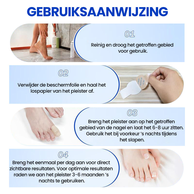 Aanbieding - Schimmelnagelpleisters