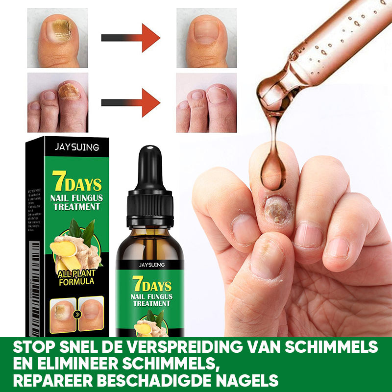 Gember Nagelbehandeling