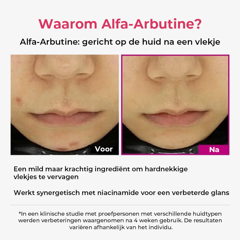 Intensief Verkleuringsserum