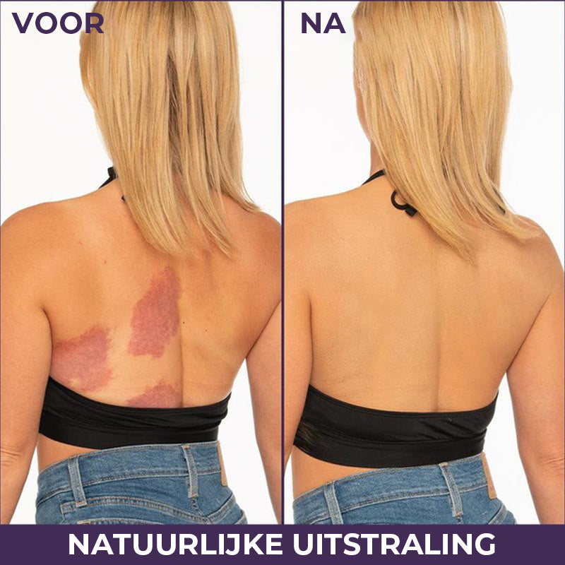 Lichaamsdekkingsperfector – Waterdichte make-up voor benen en lichaam