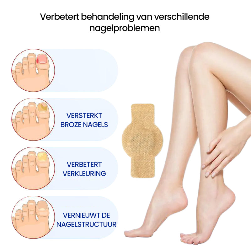 Aanbieding - Schimmelnagelpleisters
