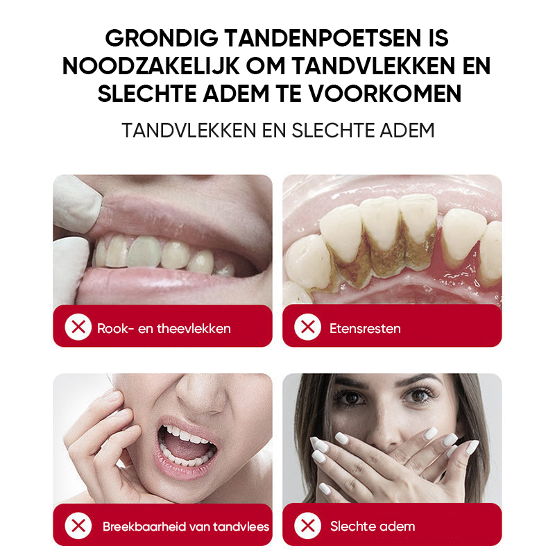 SP-8/SP-10 probiotische whitening-tandpasta voor mondgezondheid