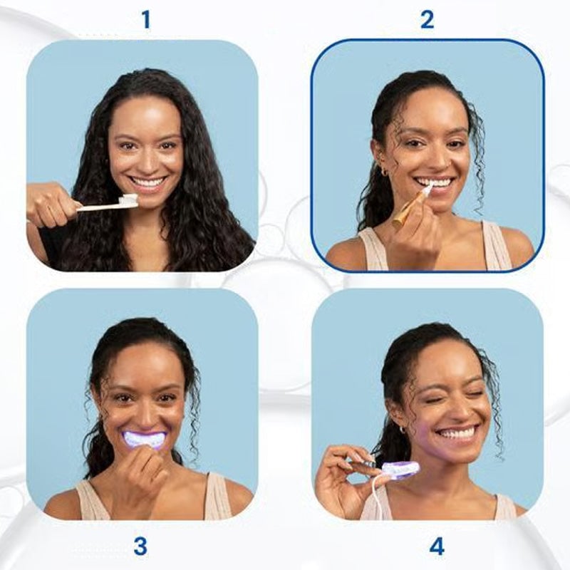 Whitening Pen voor het verwijderen van vlekken en wittere tanden