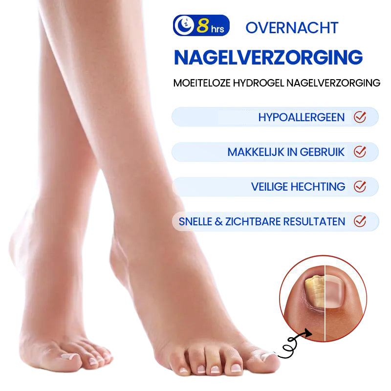 Aanbieding - Schimmelnagelpleisters
