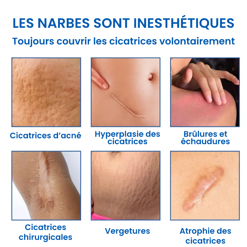 Gel Professionnel pour l'Élimination des Cicatrices