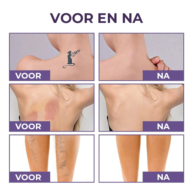 Lichaamsdekkingsperfector – Waterdichte make-up voor benen en lichaam