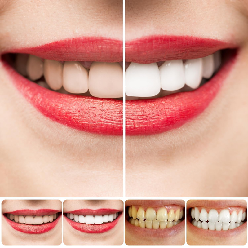 SP-8/SP-10 probiotische whitening-tandpasta voor mondgezondheid