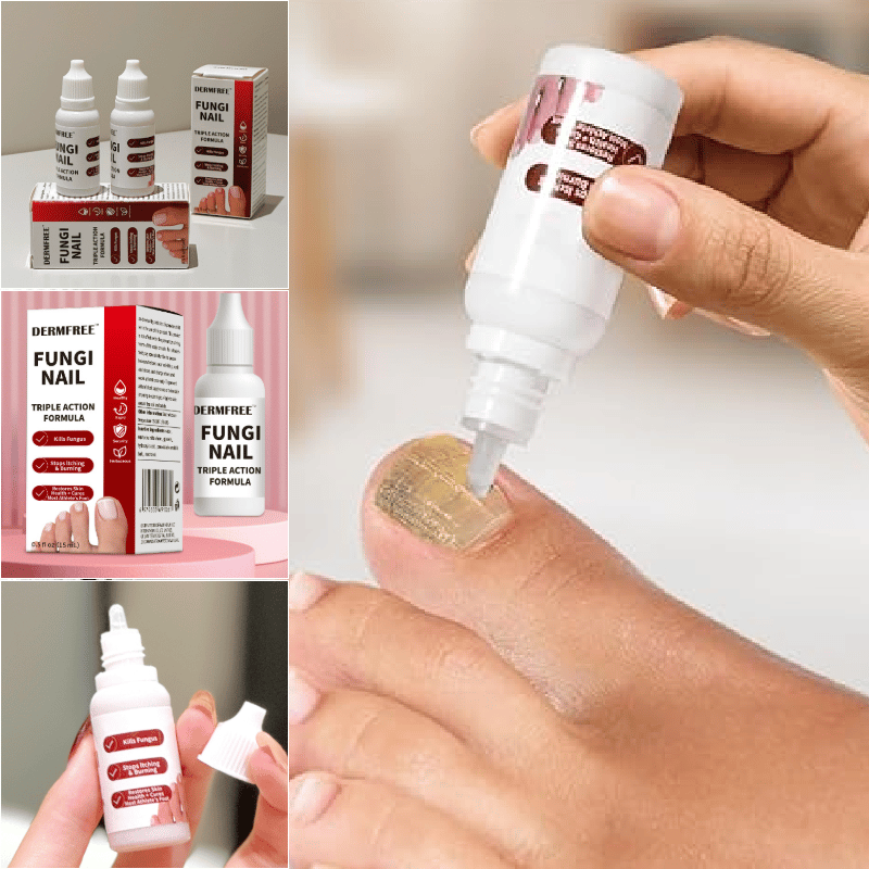 Traitement Anti Fongique Extra Fort pour Ongles d'Orteils
