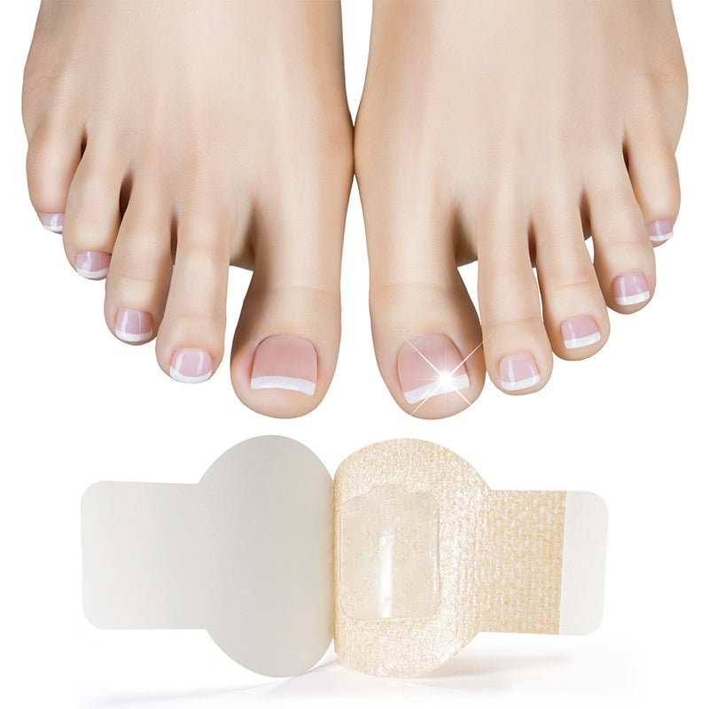 Aanbieding - Schimmelnagelpleisters