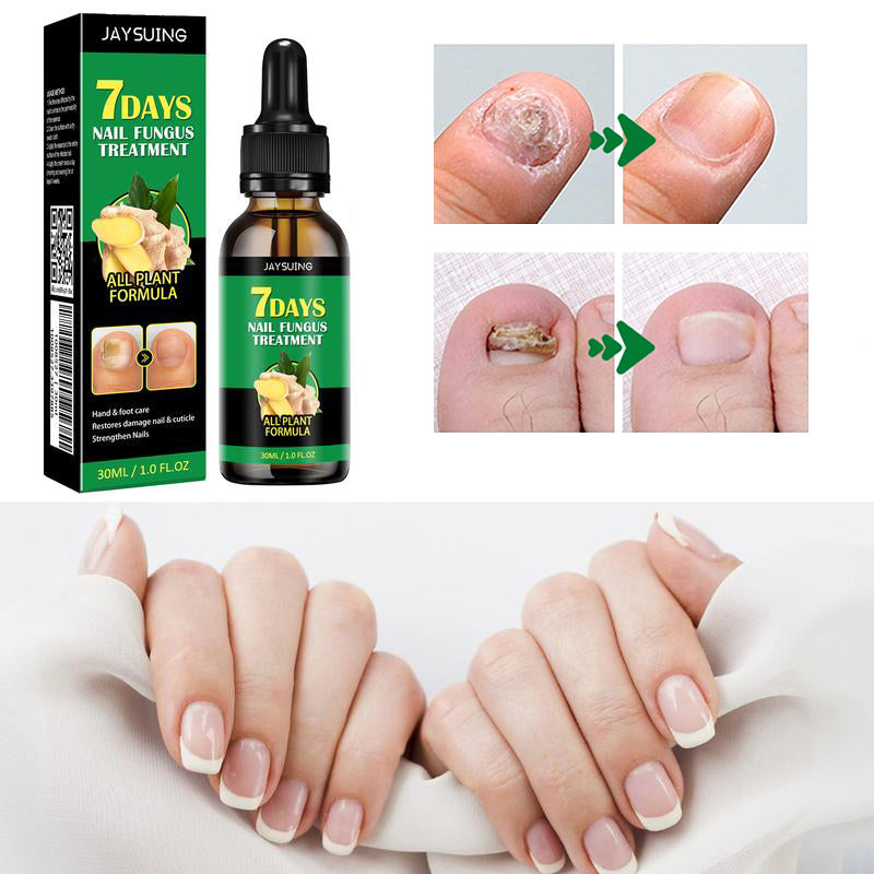 Gember Nagelbehandeling