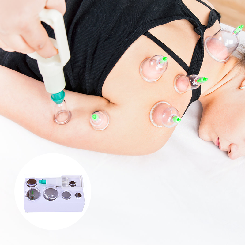 Cuppingset voor massagetherapie