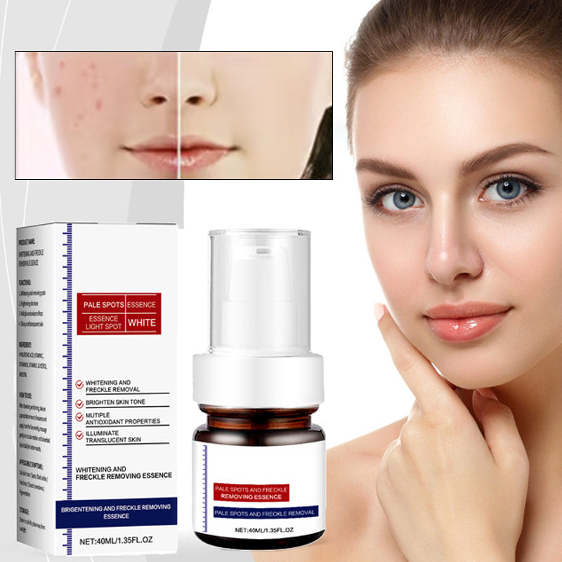 Vitamine C Whitening Freckles Gezichtscrème