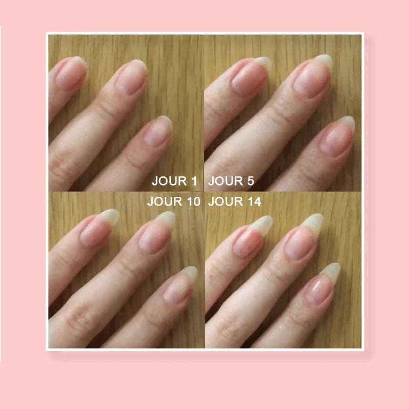 GEL DE PROTECTION POUR LA RÉPARATION DES ONGLES