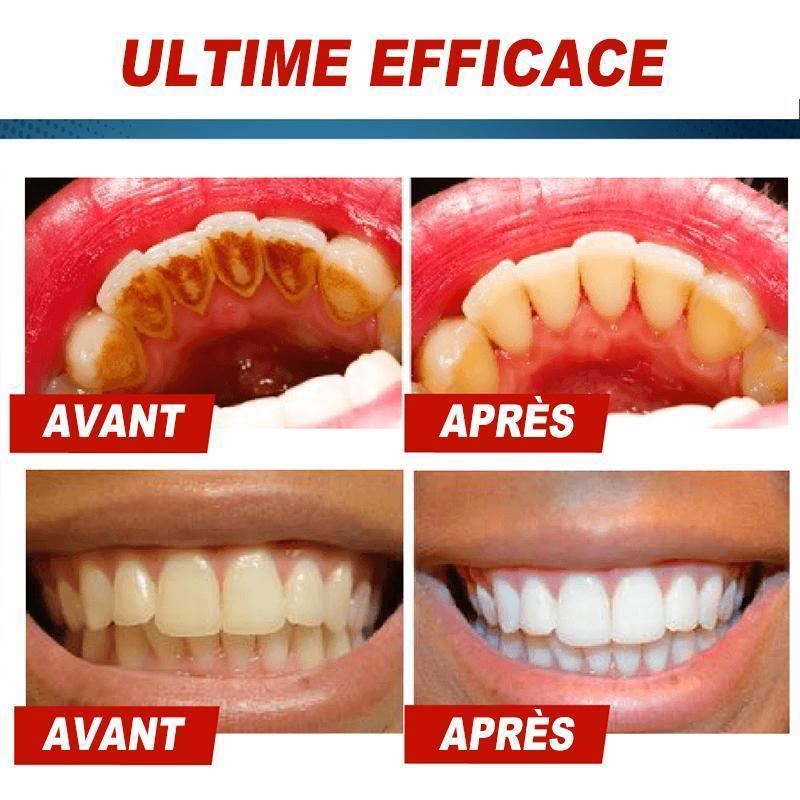 Dentifrice Blanchissant Anti-taches Intensif