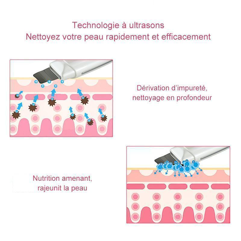 Épurateur du Visage à Vibration Ultrasonique
